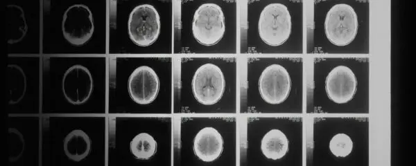 Integrative Neuroimaging